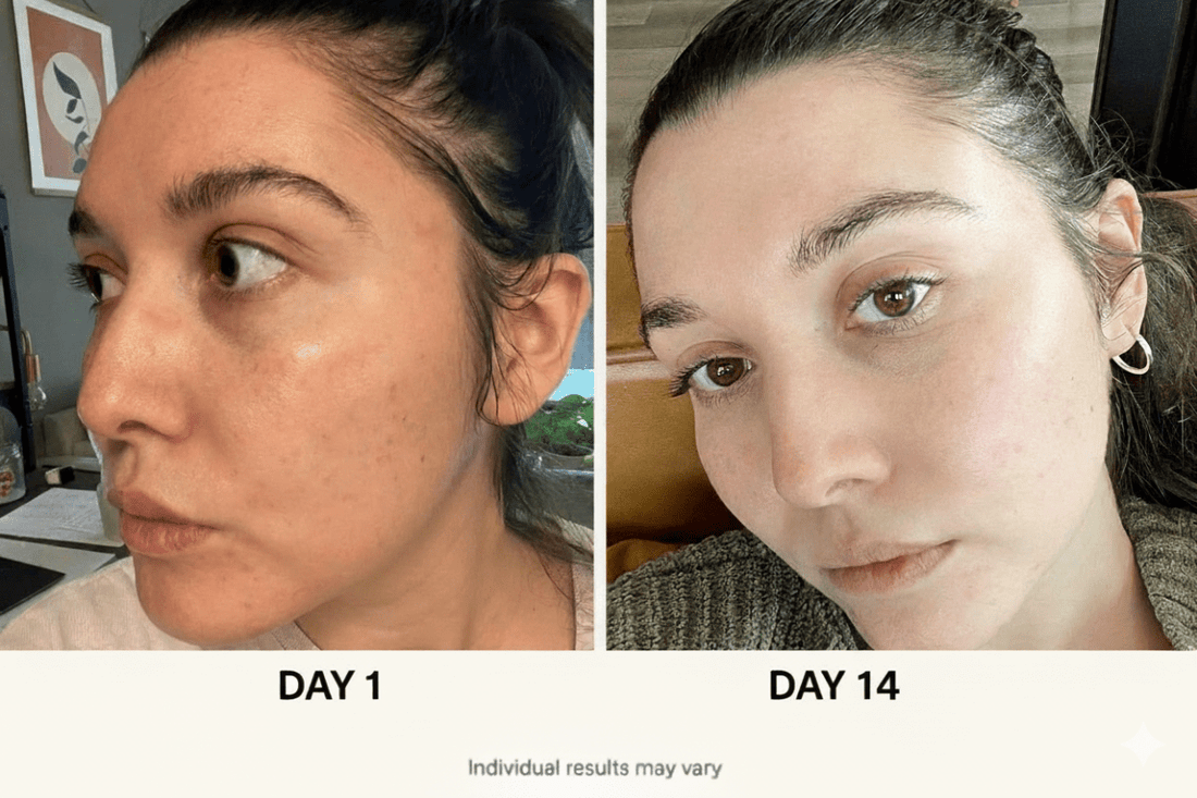 5-step Korean Skincare Set