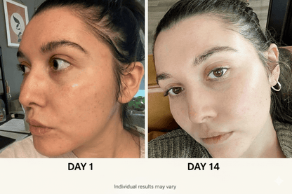 5-step Korean Skincare Set