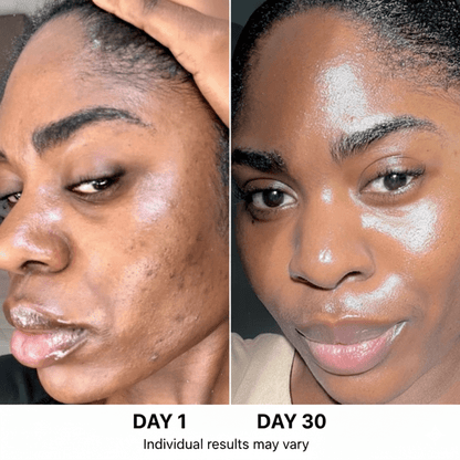 5-step Korean Skincare Set