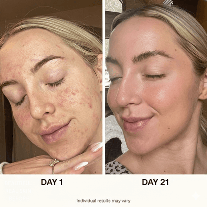 5-step Korean Skincare Set