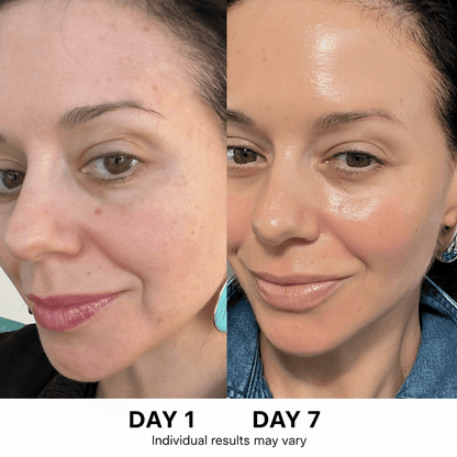 5-step Korean Skincare Set