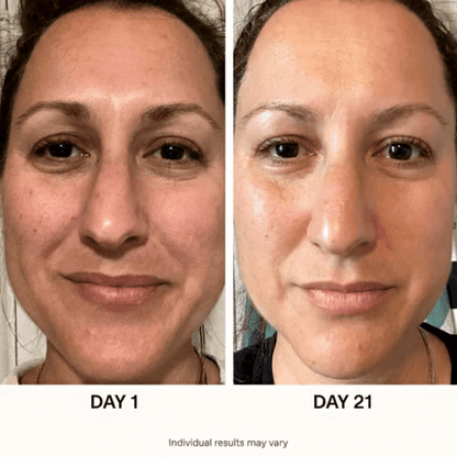 5-step Korean Skincare Set